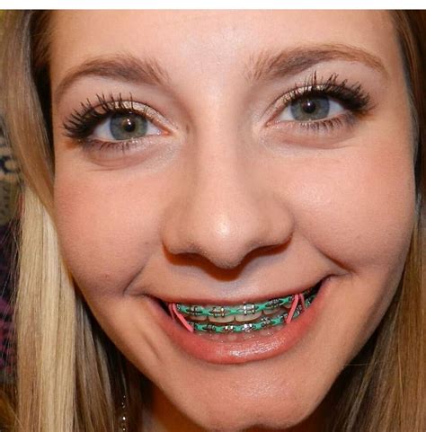 braces jewelry for women.